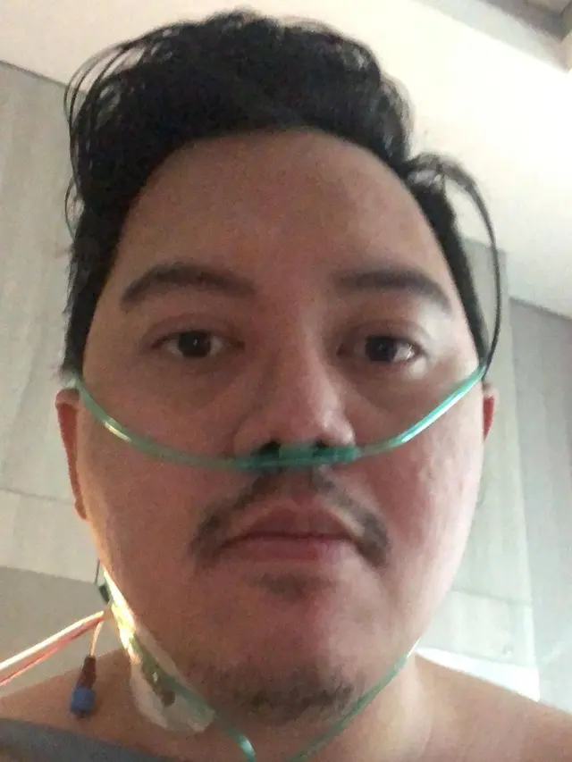 Chandra Liow Sempat Alami Badai Sitokin dan Hampir Meninggal, Ini 5 Faktanya