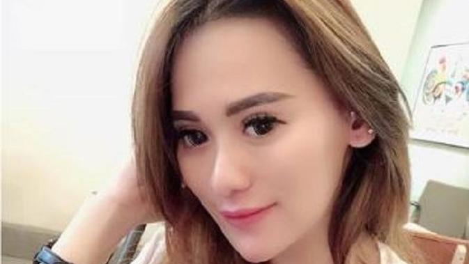 Resty Ananta (Foto: Ist)