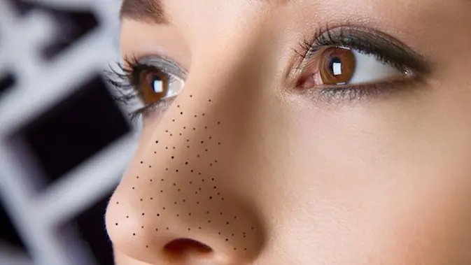 15 Cara Alami Menghilangkan Komedo Hitam Dan Putih Di Hidung Dengan Cepat Beauty Fimela Com