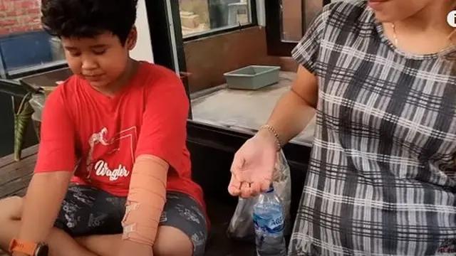 Ular Nyasar Masuk Rumah Gigit Anak Panji Petualang, Ini 6 Potret Kondisinya Sekarang