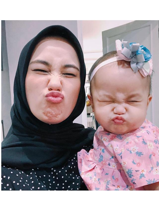 6 Pesona Anesstesia Ayu , Adik Andhika Pratama yang Bikin Gagal Fokus