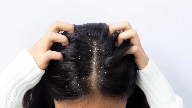 Jenis Ketombe dan Penyebabnya