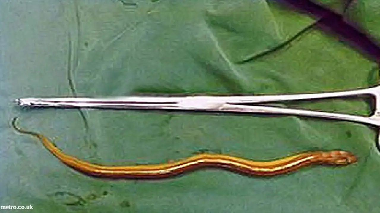 belut-masuk-kelamin-131105c.jpg