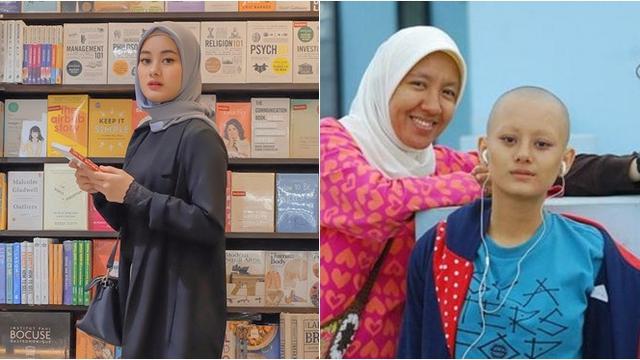 Demi Peran 5 Artis Cantik Ini Rela Tampil Botak Hot Liputan6 Com