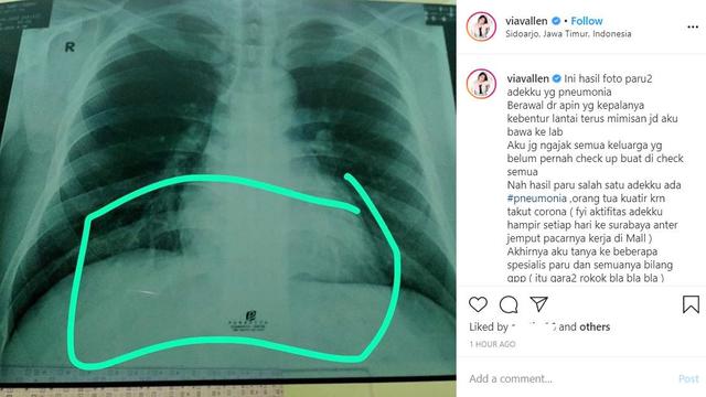 Unggahan Via Vallen (Instagram/ viavallen)