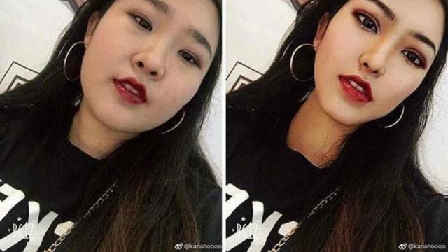 tak perlu operasi plastik 10 editan