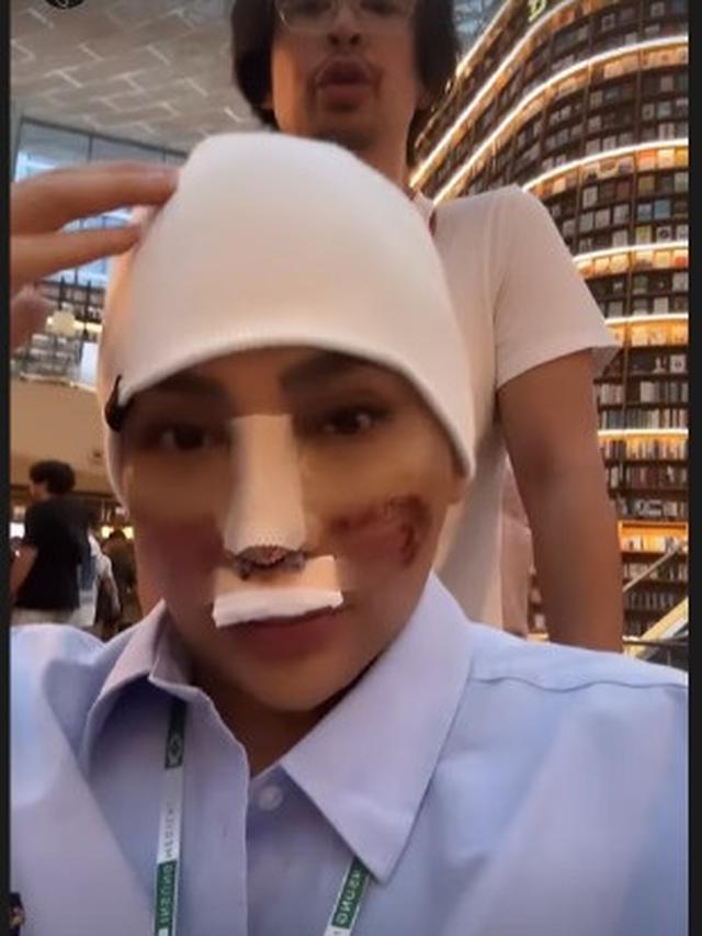 Potret Caren Delano Jalan-Jalan di Korea Usai Oplas, Wajah Masih Diperban