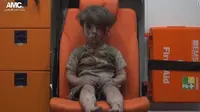 Seorang bocah yang menjadi korban luka akibat serangan di Aleppo, Suriah (AMC)