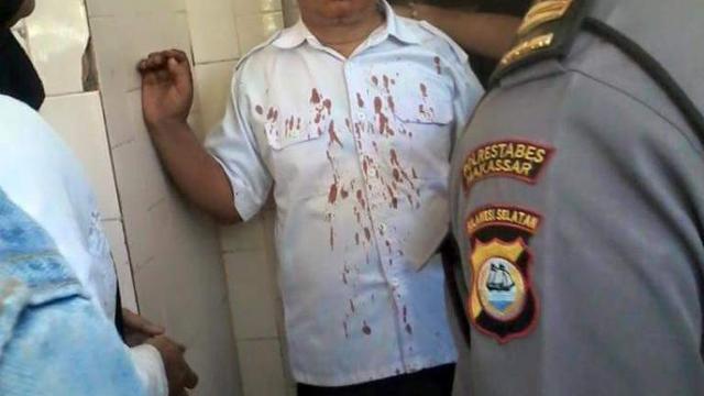 [Bintang] Begini Kondisi Guru SMKN 2 Makassar yang Dipukul Orangtua Siswa