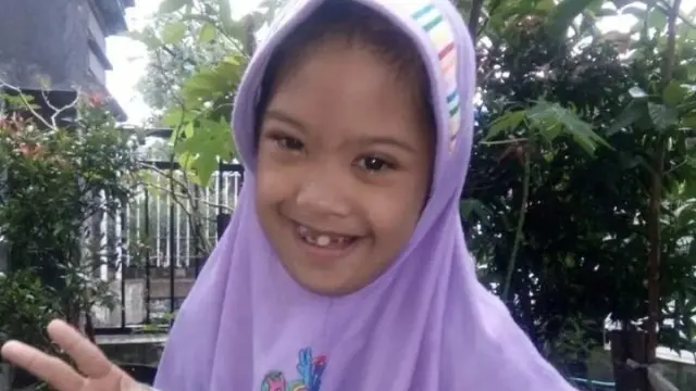 Nuzulis Sakinah penyandang down syndrome dari Gresik, Jawa Timur.