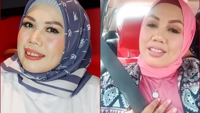 Beda Gaya Ely Sugigi Sebelum Vs Sesudah Potong Gigi (sumber: instagram/ellysugigi_real_)