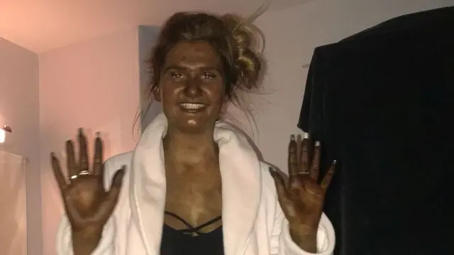 Salah Pakai Krim Tanning, Wanita Ini Terlihat Seperti Fiona ‘Shrek’