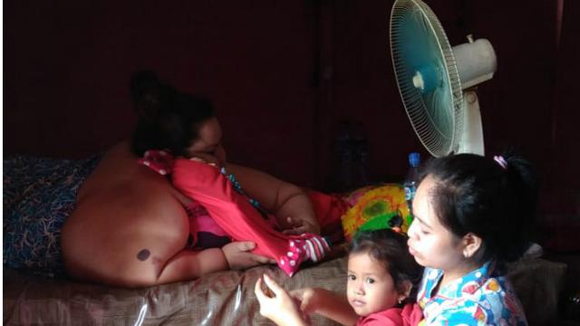 Titi Wati di Rumah Usai Operasi Pengecilan Lambung