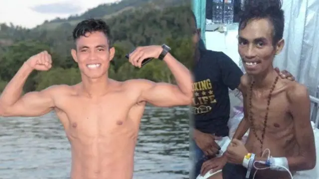 Valentinus Nahak berjuang melawan kanker (Hak Cipta: Kemenpora/frs)