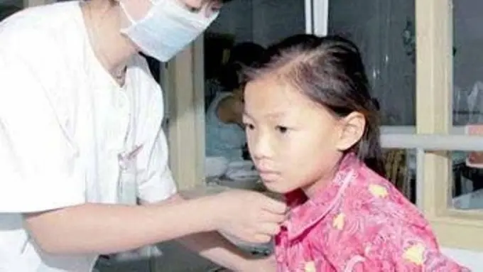 Perjuangan Hidup Yu Yuan, Gadis Penderita Leukemia