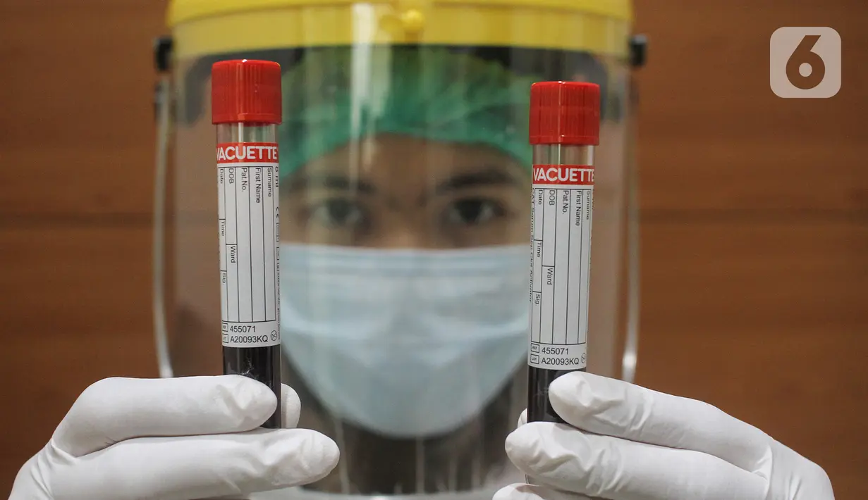 Petugas medis menunjukkan sampel darah pasien di Laboratorium Klinik Prodia Kramat, Jakarta, Sabtu (8/5/2021). Memasuki usia ke 48 tahun PT Prodia Widyahusada Tbk memberikan pemeriksaan kesehatan gratis kepada media. (Liputan6.com/HO/Prodia)