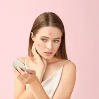ilustrasi jerawat/Pixel-Shot/shutterstock