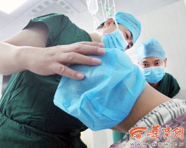 Telinga yang ditumbuhkan di tangan pasien kini berhasil dipasang di kepala pasien | Photo: Copyright shanghaiist.com