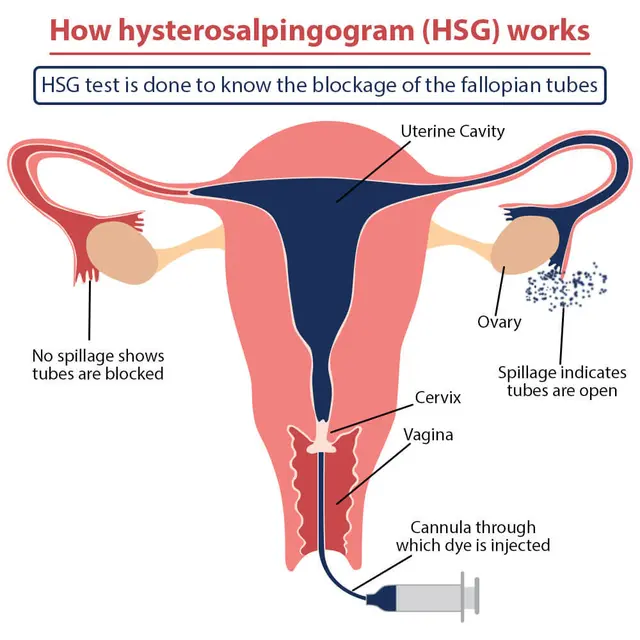 Gejala Kanker Endometrium yang Perlu Dikenali, Sempat Diidap Almarhumah Dina Mariana