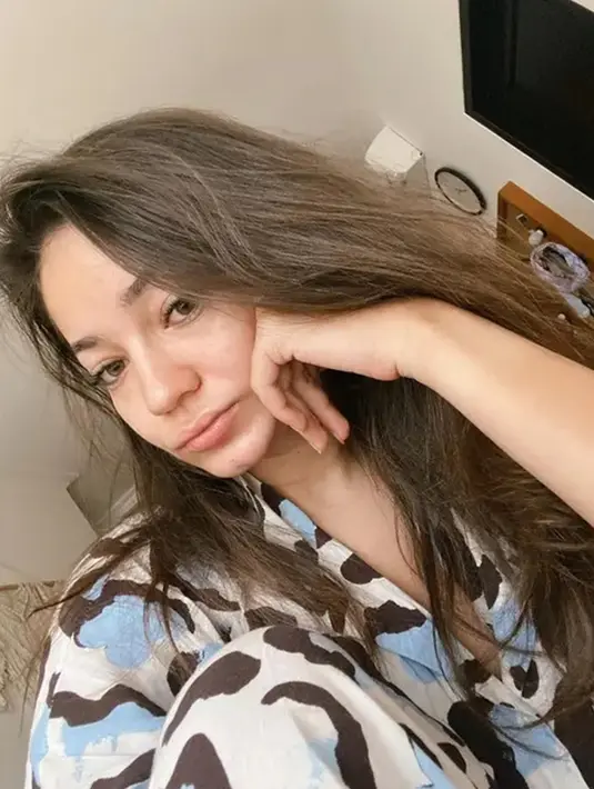 Enzy Storia saat baru bangun tidur ini parasnya menawan. Netizen kompak menyebut Enzy tetap cantik meskipun tak memakai riasa. Potret Enzy dengan muka bantal ini banjir like dan komentar. (Liputan6.com/IG/enzystoria)