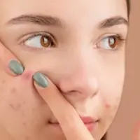 Tips memilih skincare untuk kulit sensitif/copyright pexels/Anna Nekrashevich