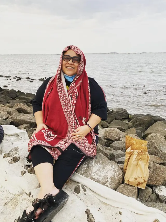 Rambut Mulai Rontok Pasca Kemoterapi, Ini 6 Potret Nunung Pakai Turban dan Wig