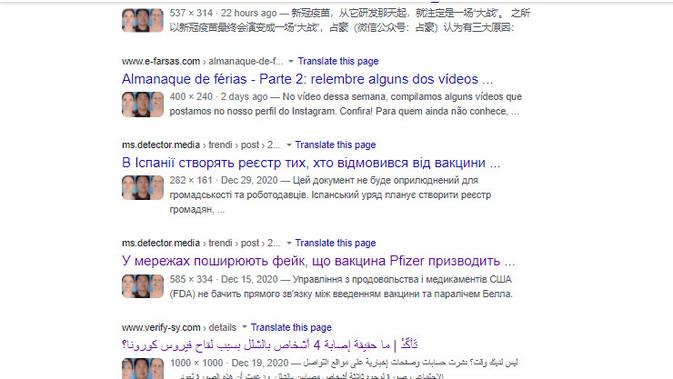 Cek Fakta Liputan6.com menelusuri klaim foto orang mengalami kelumpuhan wajah setelah divaksin corona