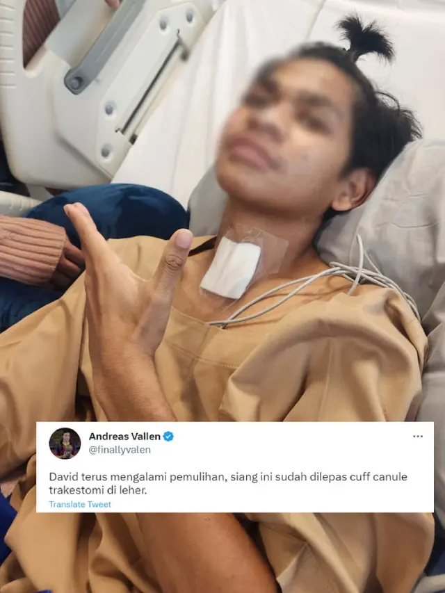 Kondisi Terkini David Ozora yang Dibagikan Pihak Keluarga. Dokter Akhirnya Melepas Selang Kanul Trakeostomi dari Leher Korban Penganiayaan Mario Dandy, Shane, dan AG (twitter.com/finallyvalen)