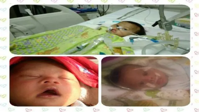 [Bintang] Derita Down Syndrome dan Infeksi Paru-paru, Bayi Berusia 8 Bulan Ini Memohon Bantuan