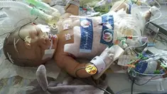 Untuk menghindari perubahan janin pada kehamilan berikutnya, dokter pun menyarankan Kate merokok sampai 50 batang satu hari.