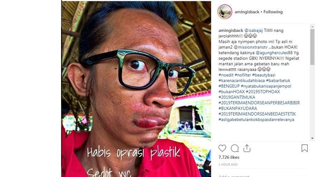 Aming (Foto: Instagram)