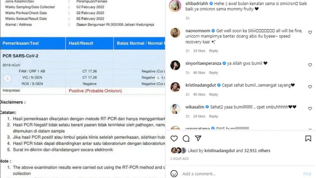 Siti Badriah positif Covid-19 varian Omicron