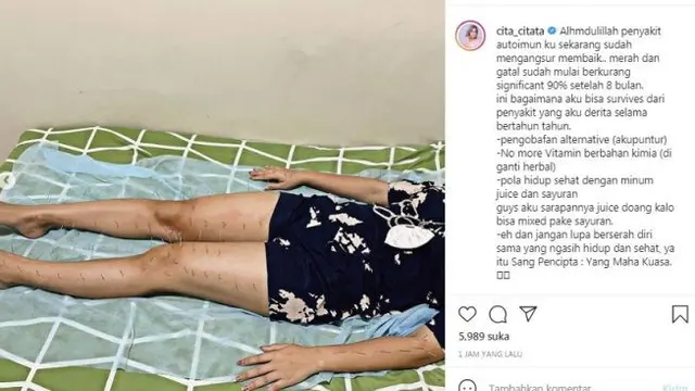 Kondisi Cita Citata