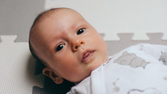 5 Obat Bintik Merah pada Bayi Baru Lahir - Parenting ...