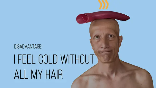 Idap Alopecia Universalis, Pria Ini Tunjukkan Kisahnya Melalui Potret Unik
