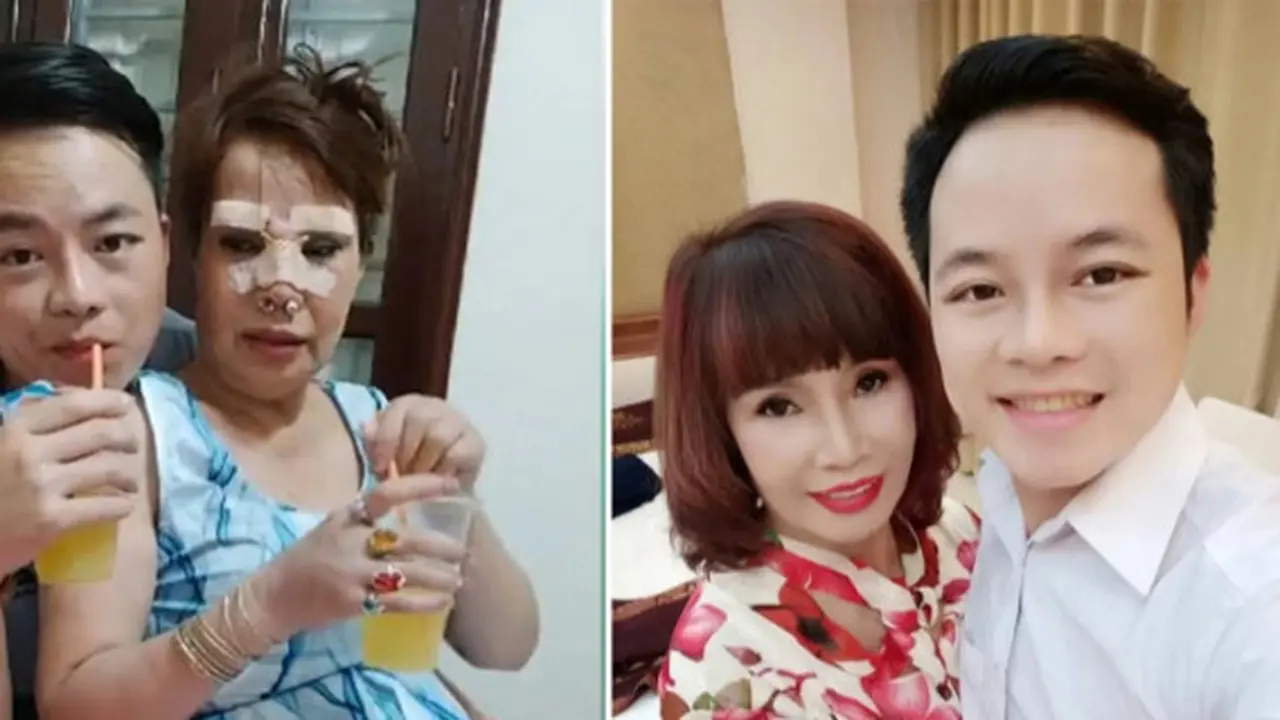 Nikahi Pria Muda, Wanita 62 Tahun Ini Rela Oplas Agar Terlihat Lebih Cantik