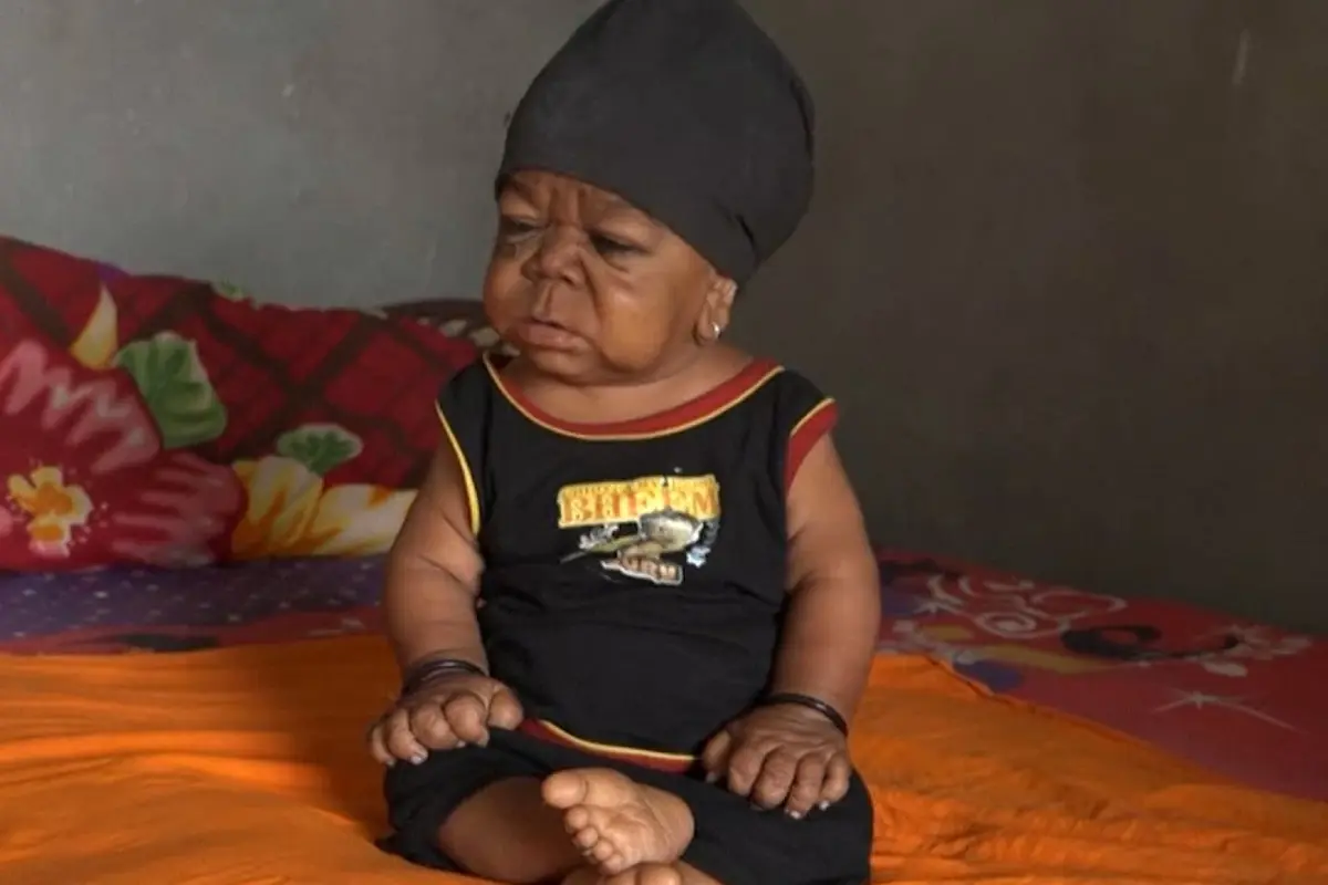 [Bintang] Mengidap Penyakit Langka, Pria Berusia 23 Tahun Miliki Fisik Seperti Bayi 1 Tahun
