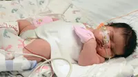 Bayi Ini Lahir dengan Berat Hampir 6 Kilogram