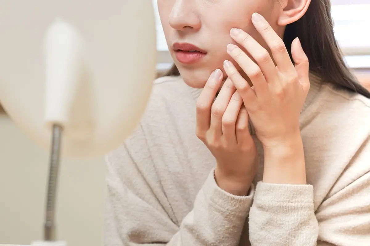 Kulit Iritasi karena Nggak Cocok Pakai Skincare? Nggak Perlu Panik, Begini Cara Mengatasinya