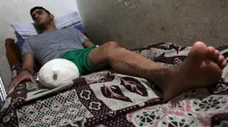 Atlet sepeda asal Palestina, Alaa Al-Daly setelah kaki kanannya diamputasi di rumahnya di Rafah, Jalur Gaza, 19 April 2018. Meskipun terluka parah, pihak Israel tak memperkenankan Daly untuk keluar dari Gaza dan menjalani perawatan. (AFP/SAID KHATIB)