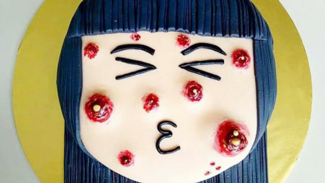 Cake Jerawat, Kue Unik yang Bikin Geli Sekaligus Penasaran