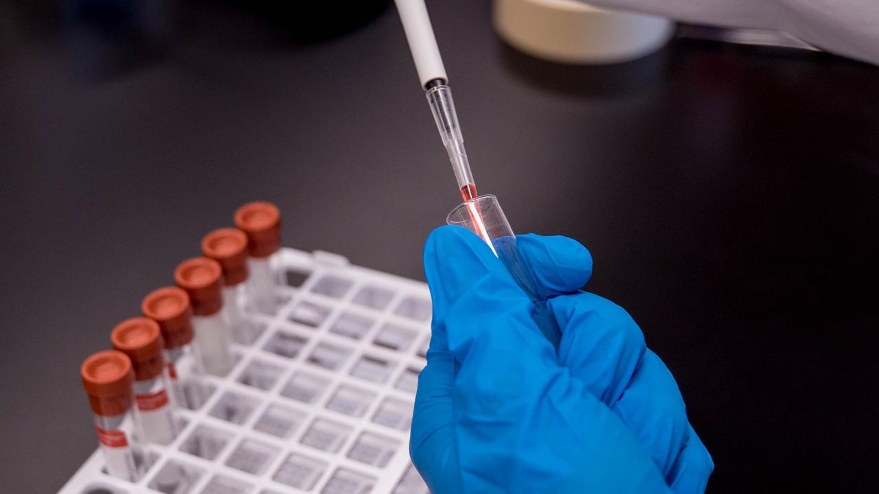 Alami Kebotakan, Kourtney Kardashian Suntik Plasma