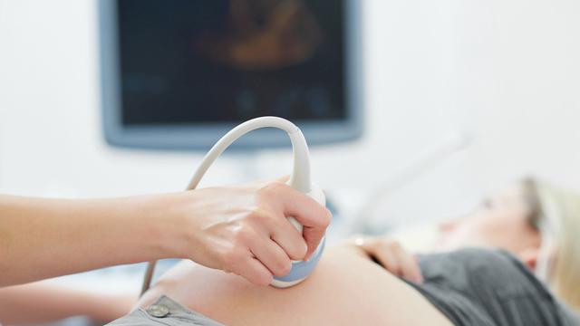 Ibu Hamil Ketahui Beda Usg 2d 3d Dan 4d Health Liputan6 Com