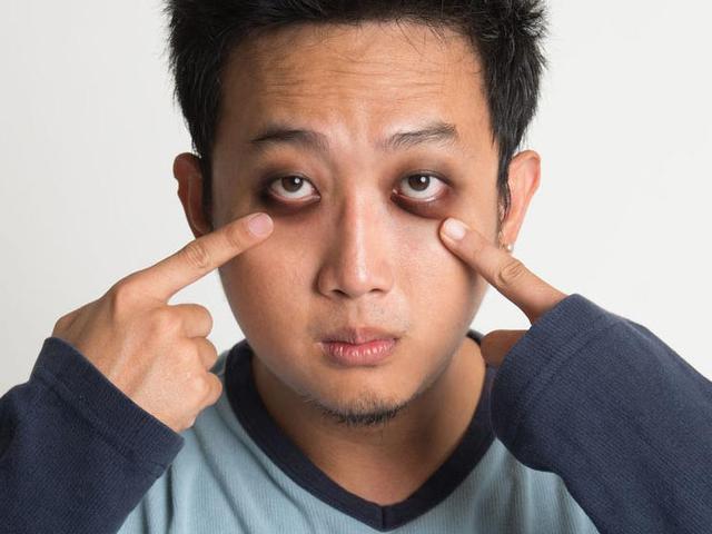 7 Cara Alami Dan Mudah Menghilangkan Mata Panda Ragam Bola Com