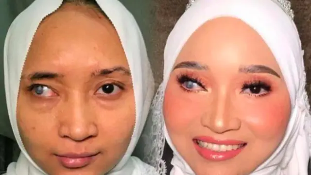 Berkat Makeup, Pengantin dengan Luka Di Wajah Tampil Cantik di Pernikahan. (Sumber: MStar)