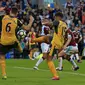 Koscielny tak mengetahui kemana arah bolanya hingga tercipta dengan tangan ke gawang Burnley. (Lindsey PARNABY / AFP)