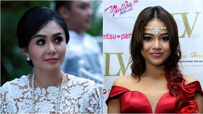 Lebih Imut Aurel Hermansyah atau Yuni  Shara  Celeb 