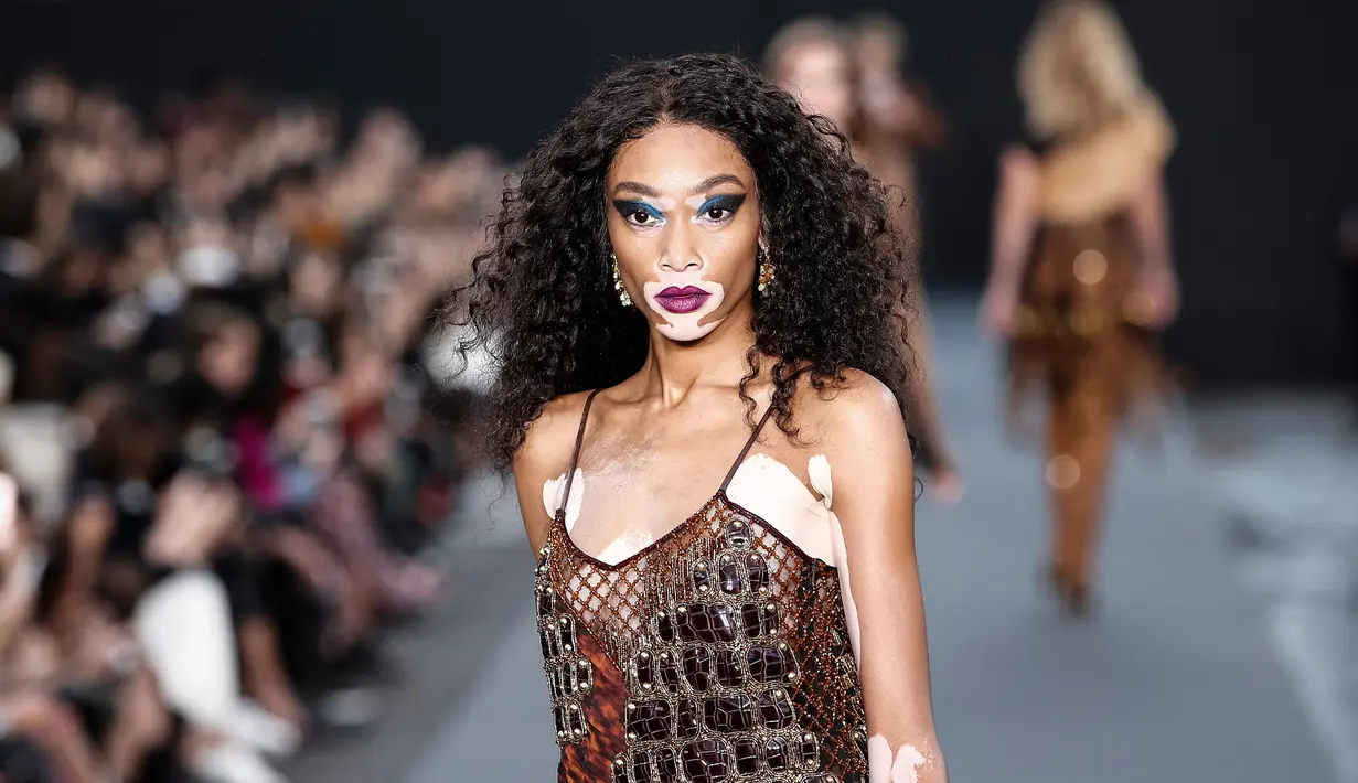 Model bernama Winnie Harlow menampilkan koleksi Spring/Summer 2018 untuk L'Oreal di Paris Fashion Week, Minggu (1/10). Namanya mencuat seiring dengan tertariknya orang memandang kulitnya yang bercorak putih. (AP Photo/Kamil Zihnioglu)