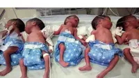 Siapa sangka pada saat persalinan ternyata ia melahirkan anak kembar 5 berjenis kelamin perempuan saat usia kandungannya tujuh bulan. 