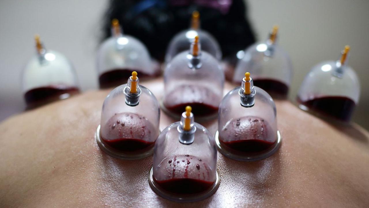 5 Mitos Kesehatan Aneh yang Dilakukan Atlet Olimpiade